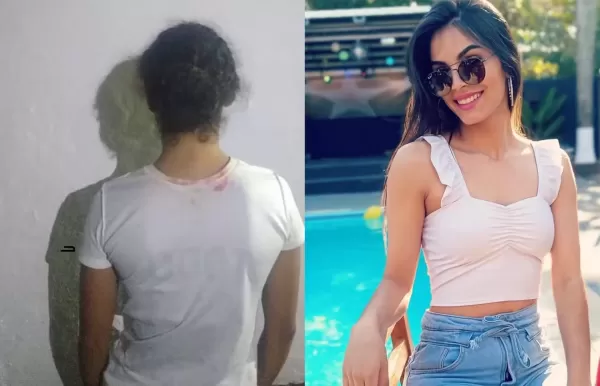 Mulher presa por atacar jovem em Jacarezinho disse ter jogado soda cáustica na vítima, afirma polícia