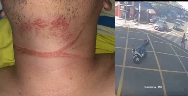 Vereador propõe que concessionárias ressarçam SUS por acidentes causados por falhas em serviços em Ourinhos 