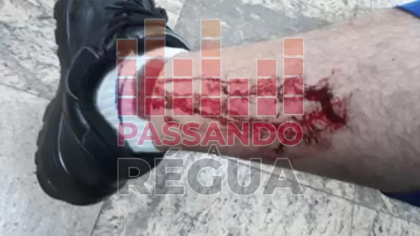 Ataque de cão a carteiro em Ourinhos reforça necessidade de cuidados dos moradores