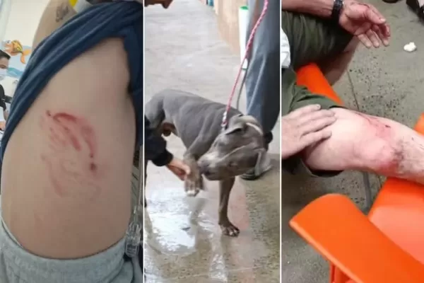 Pitbull fere criança de dois anos, pai e avô em supermercado no litoral de SP
