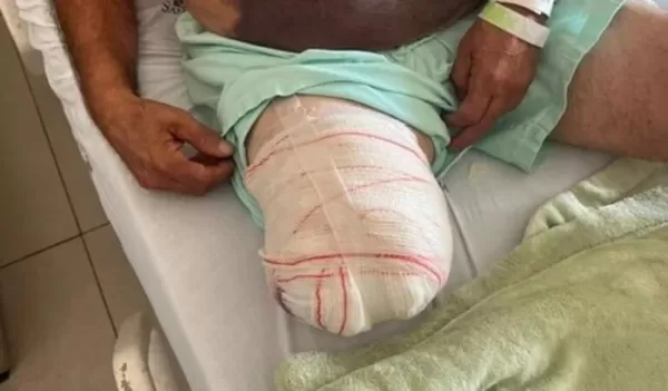 Família de Ourinhos faz vaquinha para comprar cadeira motorizada após morador amputar perna