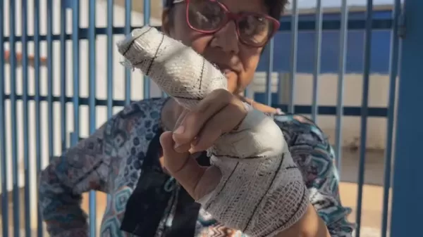 Dois ataques de pitbulls deixam feridos em Marília; mulher perde parte do dedo e cães ficam gravemente machucados