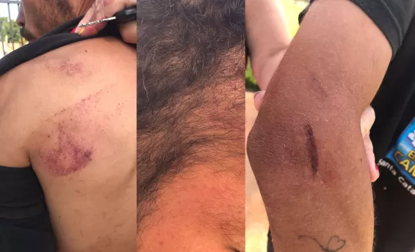 Secretário municipal é acusado de agredir com ‘pauladas’ jovem de 22 anos em Canitar 