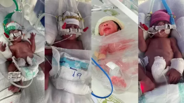 Primeiros quadrigêmeos nascem no HU de Londrina e emocionam pais após longa jornada de tentativas