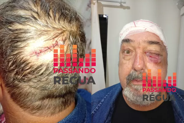 Comerciante de 58 anos é brutalmente agredido com barra de ferro em Ourinhos
