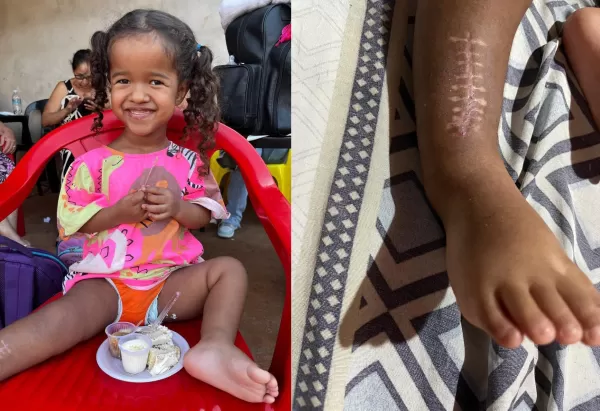 Após cirurgia bem-sucedida, menina de 4 anos precisa de órtese de R$ 6 mil para continuar recuperação