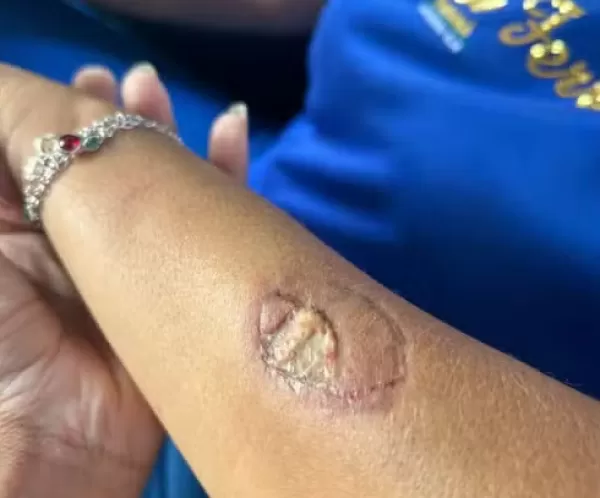 Mãe agride funcionárias e morde vice-diretora em colégio estadual em Andirá 