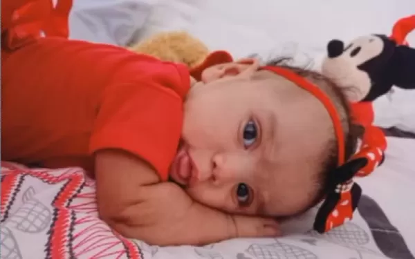 Bebê de cinco meses morre após ser atacada por cachorro, diz polícia