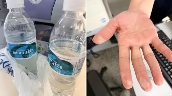 Homem segue internado após beber água possivelmente contaminada em Garça; garrafas do lote foram recolhidas