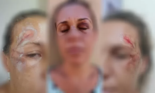 Mulher relata agressões por mais de 30 minutos em Ipaussu; motorista agrediu mulher durante chamada de vídeo com a mãe da vítima 