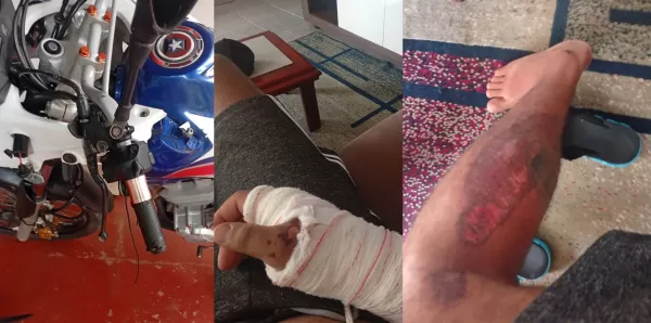 Motociclista fica gravemente ferido após queda em Ourinhos e pede apoio para vaquinha solidária