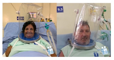 Santa Casa da região divulga imagens e fala sobre bons resultados obtidos com a utilização dos capacetes Elmo