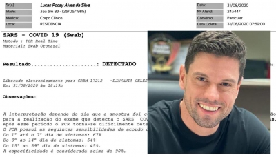 Prefeito de Ourinhos, Lucas Pocay, anuncia que está com Covid-19 e publica exame 
