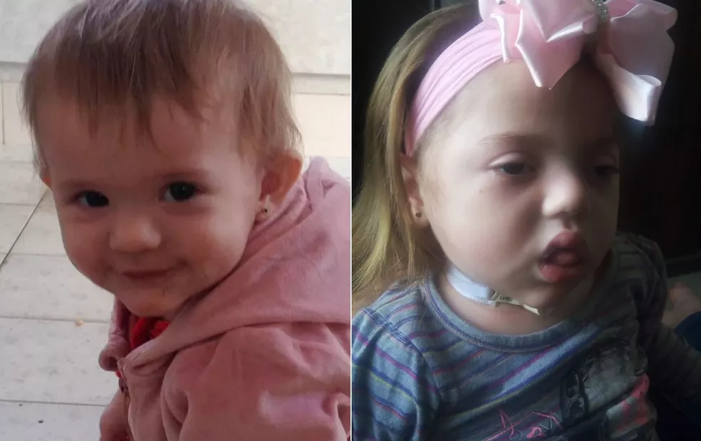 Bebê que se afogou em balde e perdeu movimentos completa 2 anos na região