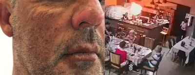 Empresário sofre queimaduras em explosão de forno em Santa Cruz do Rio Pardo; vídeo