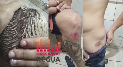 Rapaz denuncia agressões por ter admitido que é simpatizante do PT e de Lula em Ourinhos 
