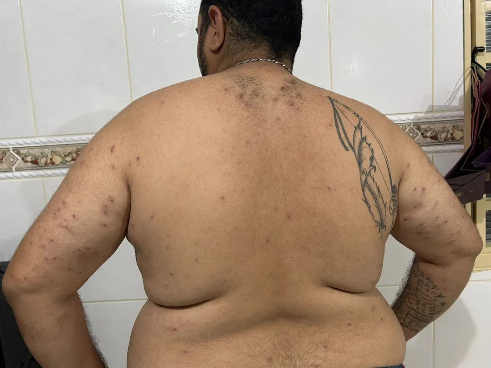 Porteiro sobrevive a ataque de enxame com mais de mil abelhas na região 