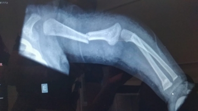 Pai é preso acusado de arremessar filha de três meses contra carrinho na região; bebê quebrou o braço 