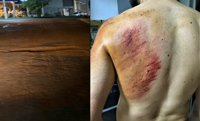 Ciclistas caem em buraco aberto na via pública e ficam feridos em Ourinhos