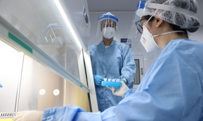 Fiocruz vai fabricar 60 milhões de testes de antígeno para Covid-19