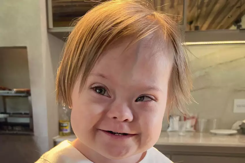 Garoto com síndrome de down, que viralizou lutando pela vida, Super Chico morre em Bauru aos 6 anos