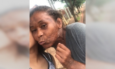 Dono de cães que mataram mulher em Ourinhos diz ser inocente; ele disse que dormia quando aconteceram os ataques e alguém teria aberto o portão e os Pitbulls escaparam 