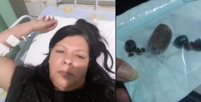 Após apelo e choro nas redes sociais, mulher consegue cirurgia na vesícula em Ourinhos 