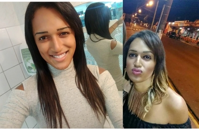 Jovem transexual morre após fazer aplicações de silicone industrial no corpo na região