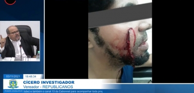 Vereador aponta falta segurança pública em Ourinhos e destaca caso de homem esfaqueado no rosto