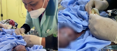 Técnica de enfermagem salva a vida de bebê prematuro em Ibirarema