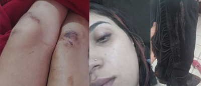 Jovem registra supostas agressões praticadas por seguranças da FAPI e afirma que pode ter sido vítima de violência sexual 