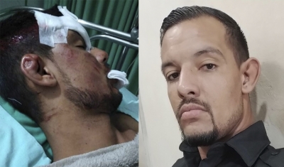 Passado um ano, segurança que foi espancado em festa em Ourinhos aguarda que a justiça seja feita