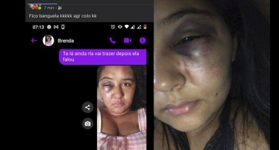 Jovem denuncia ex-namorado por agredi-la e expô-la nas redes sociais em Ourinhos 