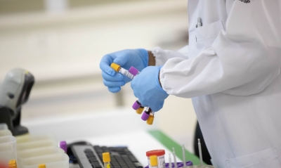 Médica testa positivo para Covid, gripe e resfriado na região 